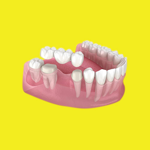 qode-np-item